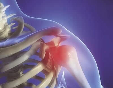 肩周炎如何做康复运动